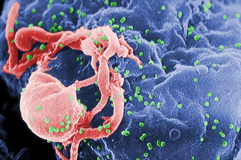 AIDS increases among young people amid health spending cuts, researcher warns