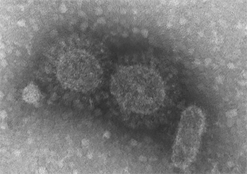 Novo coronavírus acelera produção e difusão científica