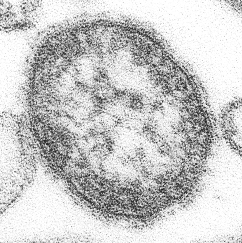 Um terço das pessoas entre 10 e 40 anos não tem anticorpos contra sarampo no interior paulista