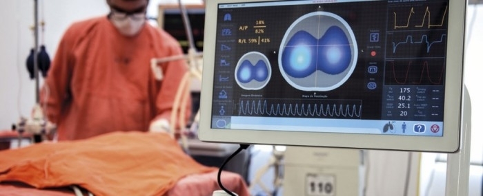 Technology optimizes use of mechanical ventilation and ICU beds