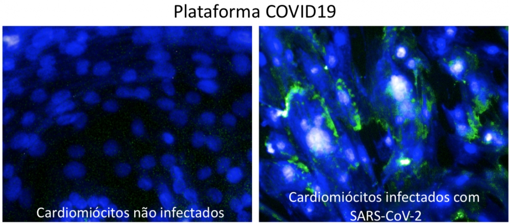 Novo coronavírus é capaz de infectar as células do músculo cardíaco