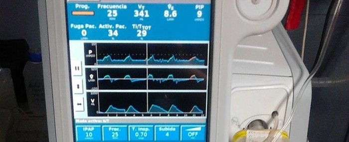 Brazilian firm refines mechanical ventilation technology