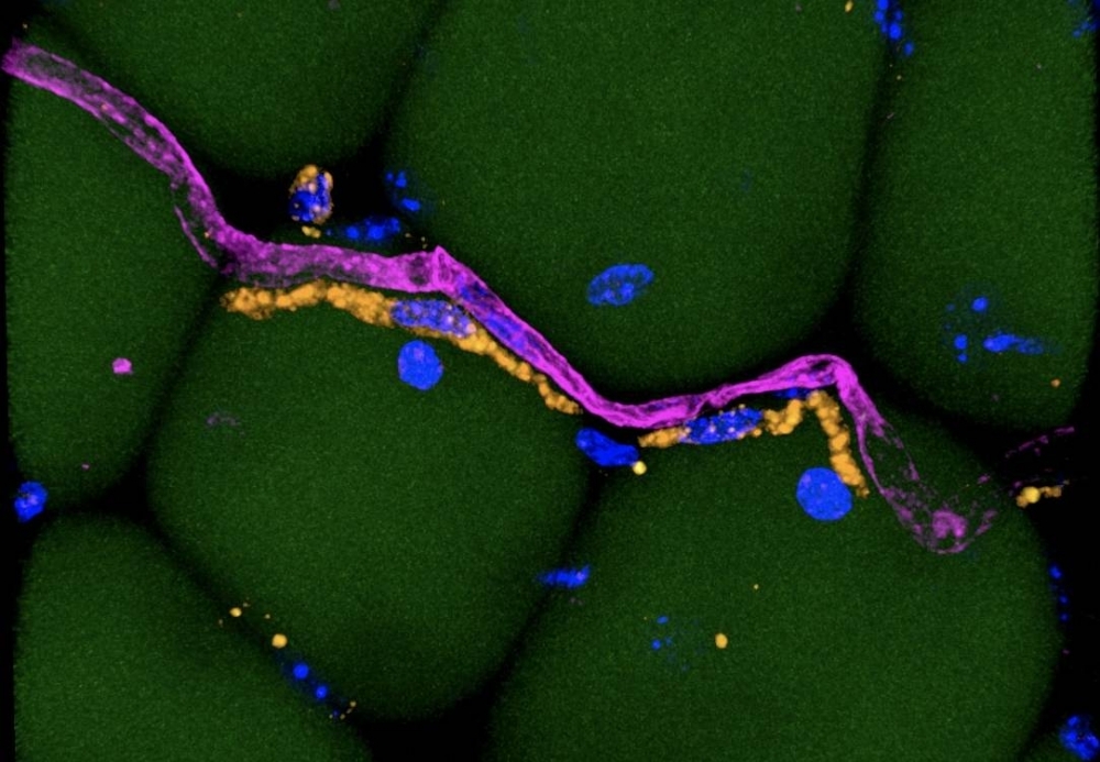 Researchers will study body fat immune cells to understand obesity-associated inflammation