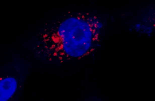 Técnica de baixo custo permite ver o novo coronavírus dentro da célula em 3D