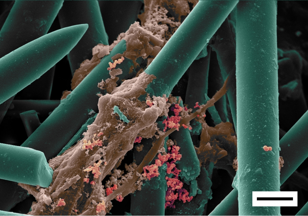 Cientistas criam membrana cutânea e estrutura para enxertos ósseos com colágeno de esponjas marinhas
