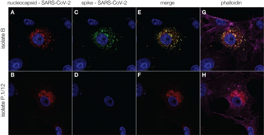 Antibodies against SARS-CoV-2 induced by prior infection are six times less effective against P.1 variant
