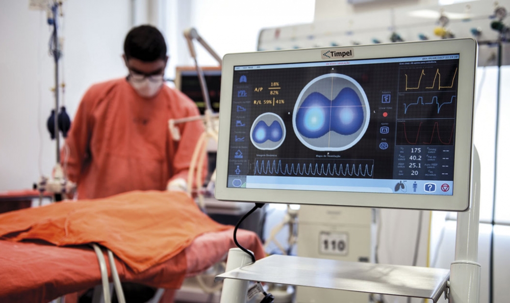 Tecnologia brasileira reduz em 80% o uso de ‘pulmão artificial’ em pacientes com insuficiência respiratória aguda