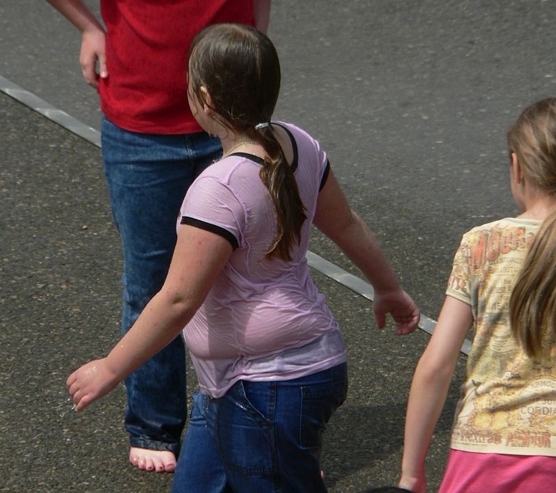 Obese girls face heightened risk of cardiovascular disease in adulthood more often than obese boys