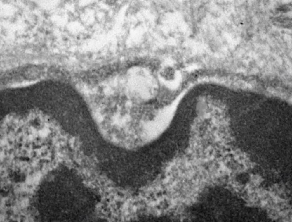 Novo coronavírus infecta e se replica em células das glândulas salivares