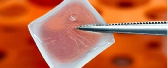 Biodressing made from stem cells permits smart treatment of wounds and burns