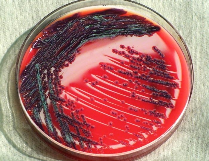 Ao ‘roubar’ zinco e ferro do hospedeiro, bactéria oportunista aumenta sua virulência