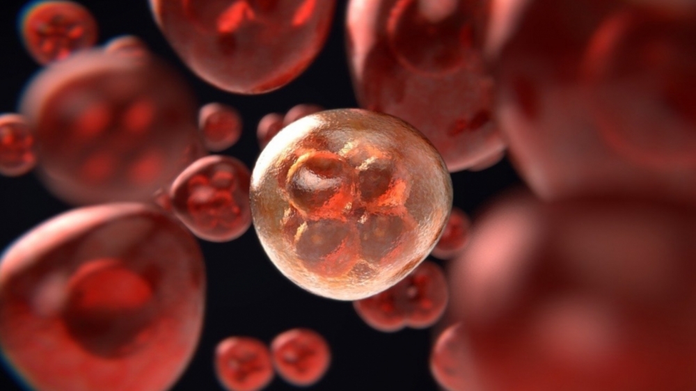 Study details benefits of stem cell transplant for systemic sclerosis patients
