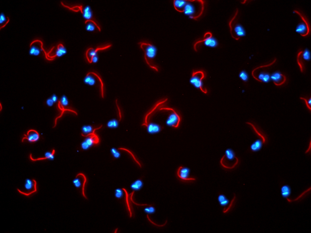 Fenômeno que normalmente leva células humanas à morte parece ser vital para parasitas, aponta estudo