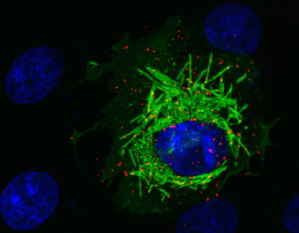 Study reveals how novel coronavirus manipulates cells to replicate