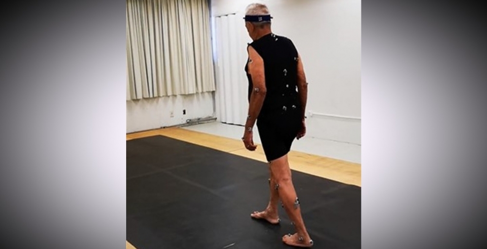 Artificial intelligence helps detect gait alterations and diagnose Parkinson’s disease