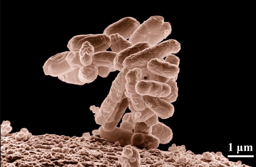 Grupo da Unifesp investiga a diversidade de bactérias <i>E. coli</i> em pacientes hospitalizados