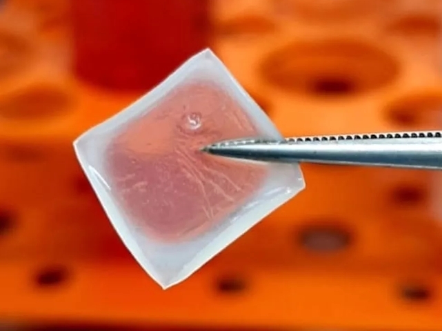 Biodressing accelerates skin wound healing in diabetic mice