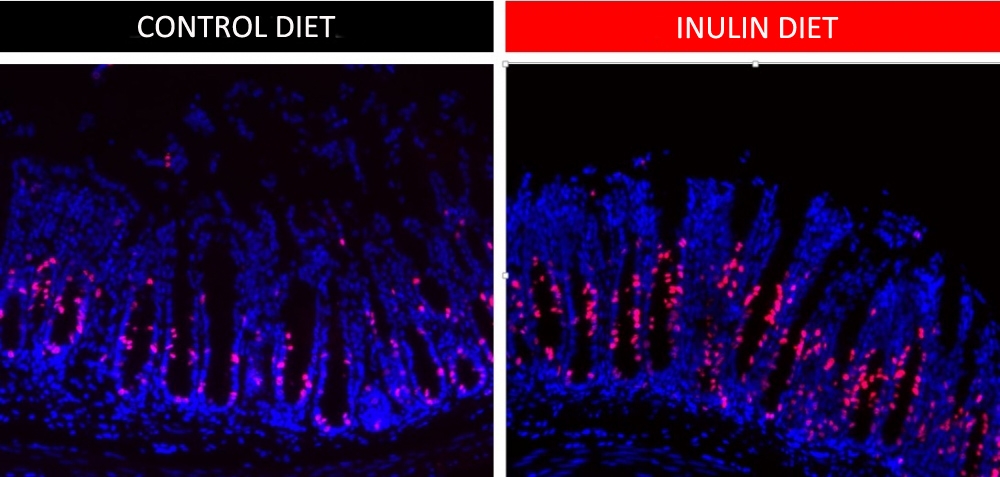 Consumption of soluble dietary fiber favors renewal of intestinal epithelial cells, study shows
