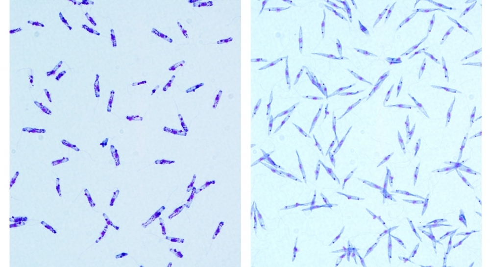 Co-infection by novel species of parasite is confirmed in visceral leishmaniasis patient