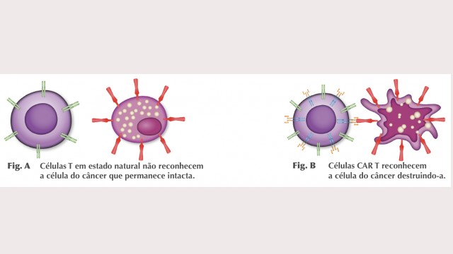 Núcleo de Terapia Avançada produzirá as células CAR-T que serão usadas contra o câncer em ensaio clínico