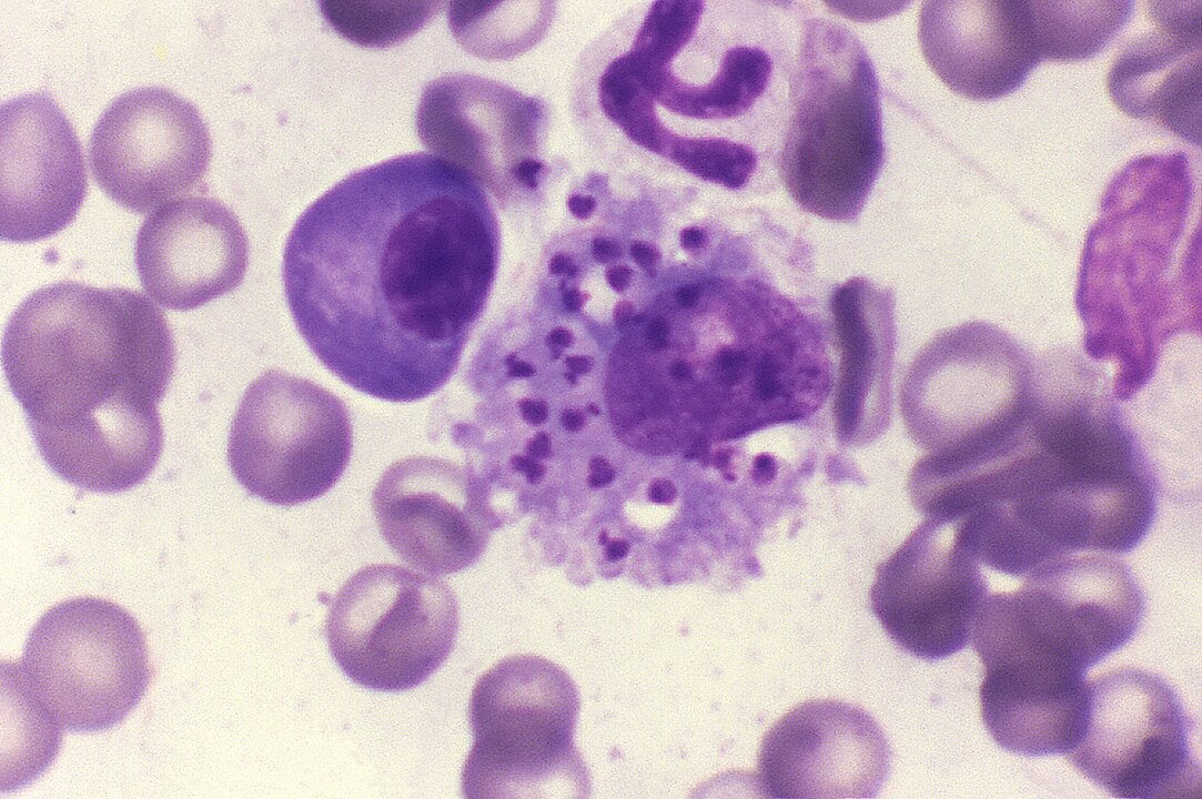 Teste permite detectar coinfecção por nova espécie de parasita em casos graves de leishmaniose visceral
