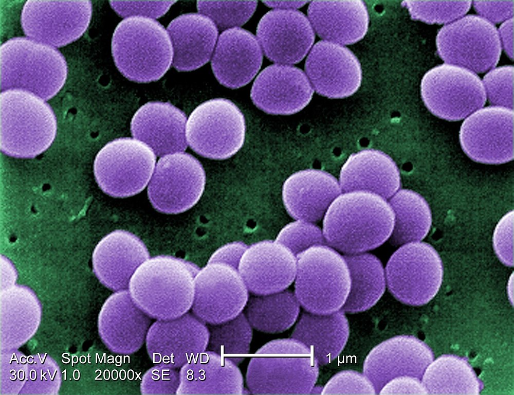 Photodynamic action weakens resistance to antibiotics in bacteria that attack airways