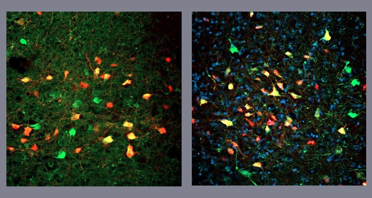 Pesquisadores descobrem neurônios que deflagram a busca frenética por alimentos, mesmo sem fome