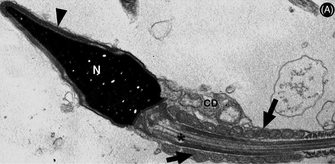 Vírus da COVID-19 pode permanecer no espermatozoide até 110 dias após a infecção
