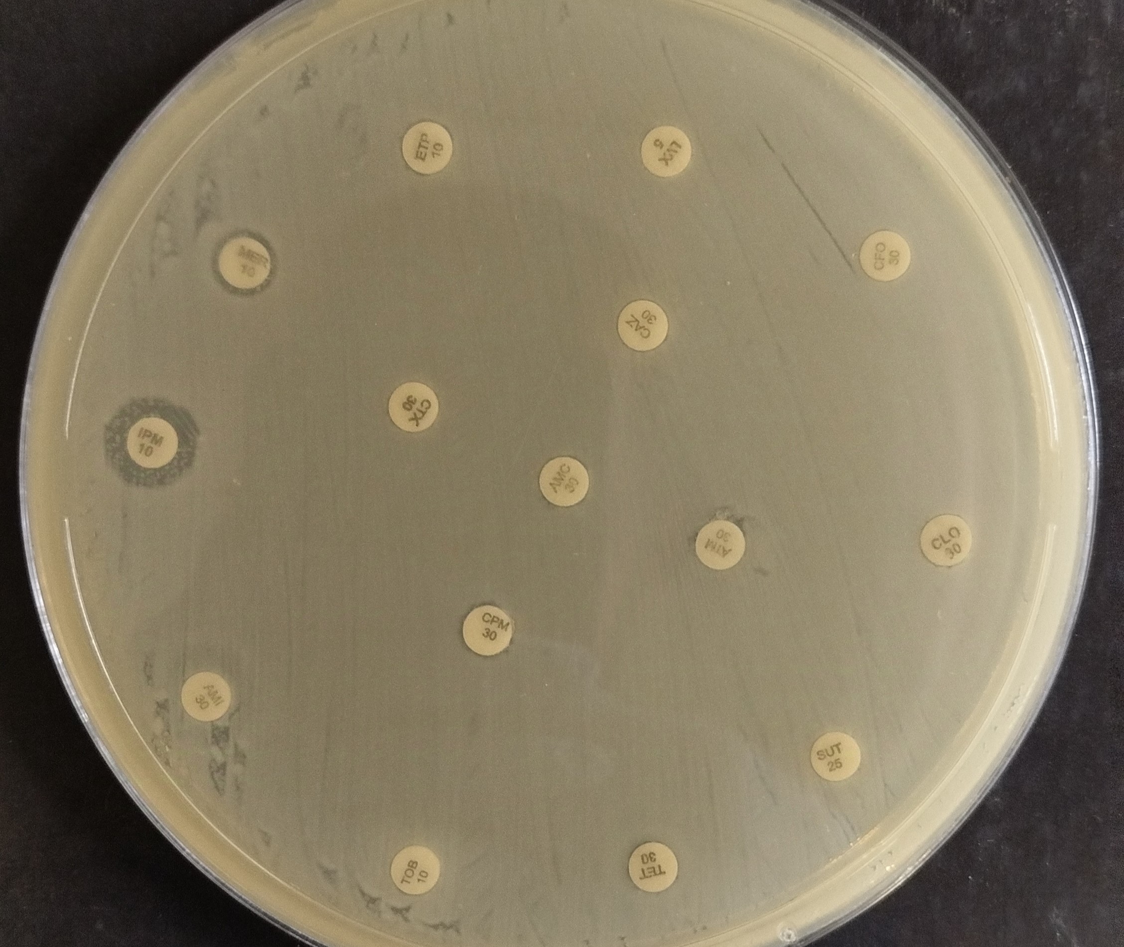 Bactéria multirresistente que representa risco global de saúde é detectada no Nordeste