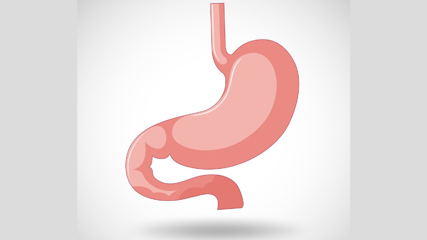 Study reveals cause of one of the main complications of bariatric surgery