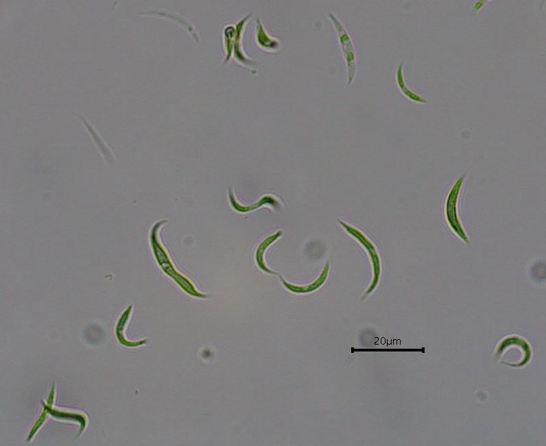 Microalgae remove antibiotic residues from wastewater, reducing environmental contamination