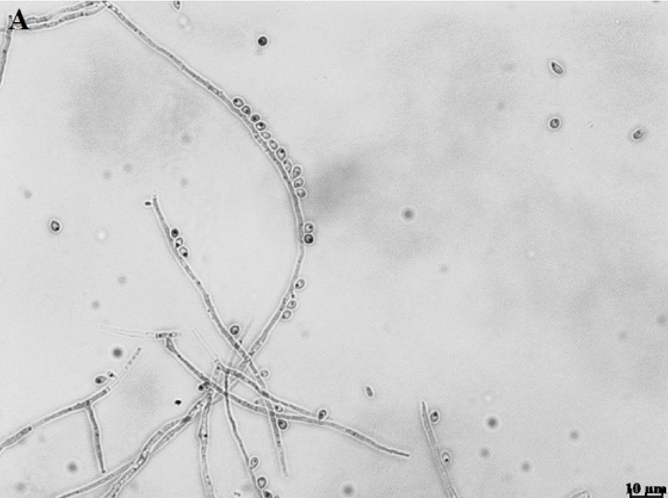 New center will study endemic fungal diseases in Latin America