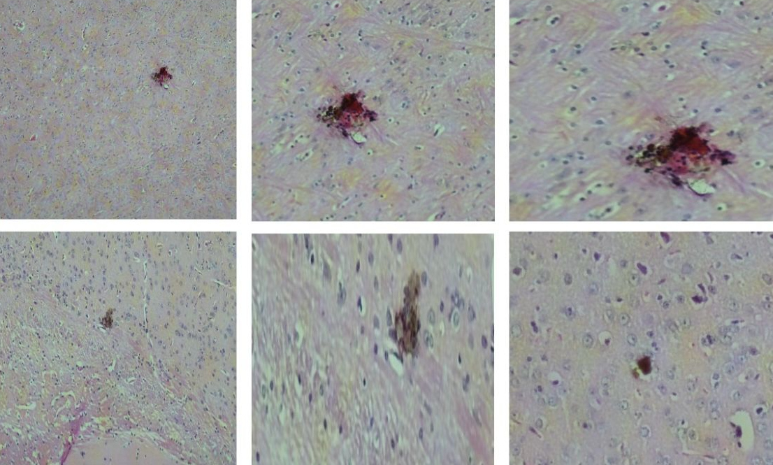 Vacina contra o vírus zika mostra resultados promissores em testes com camundongos