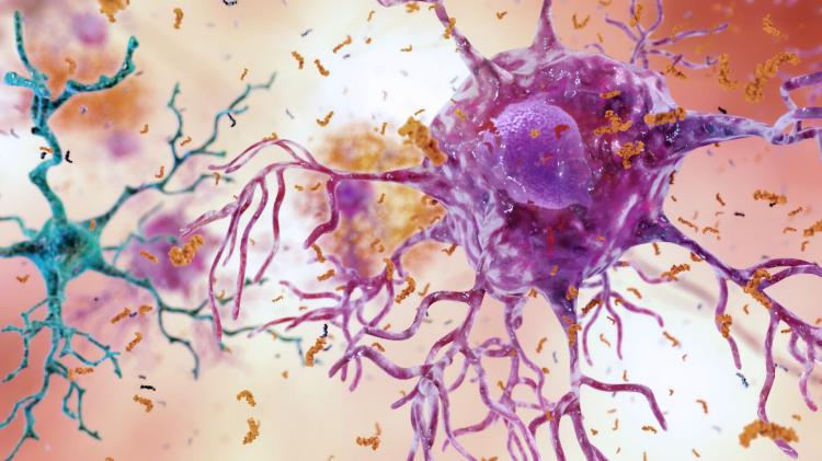 A high-fat diet induces inflammation in the brain, attracting immune cells from all over the body