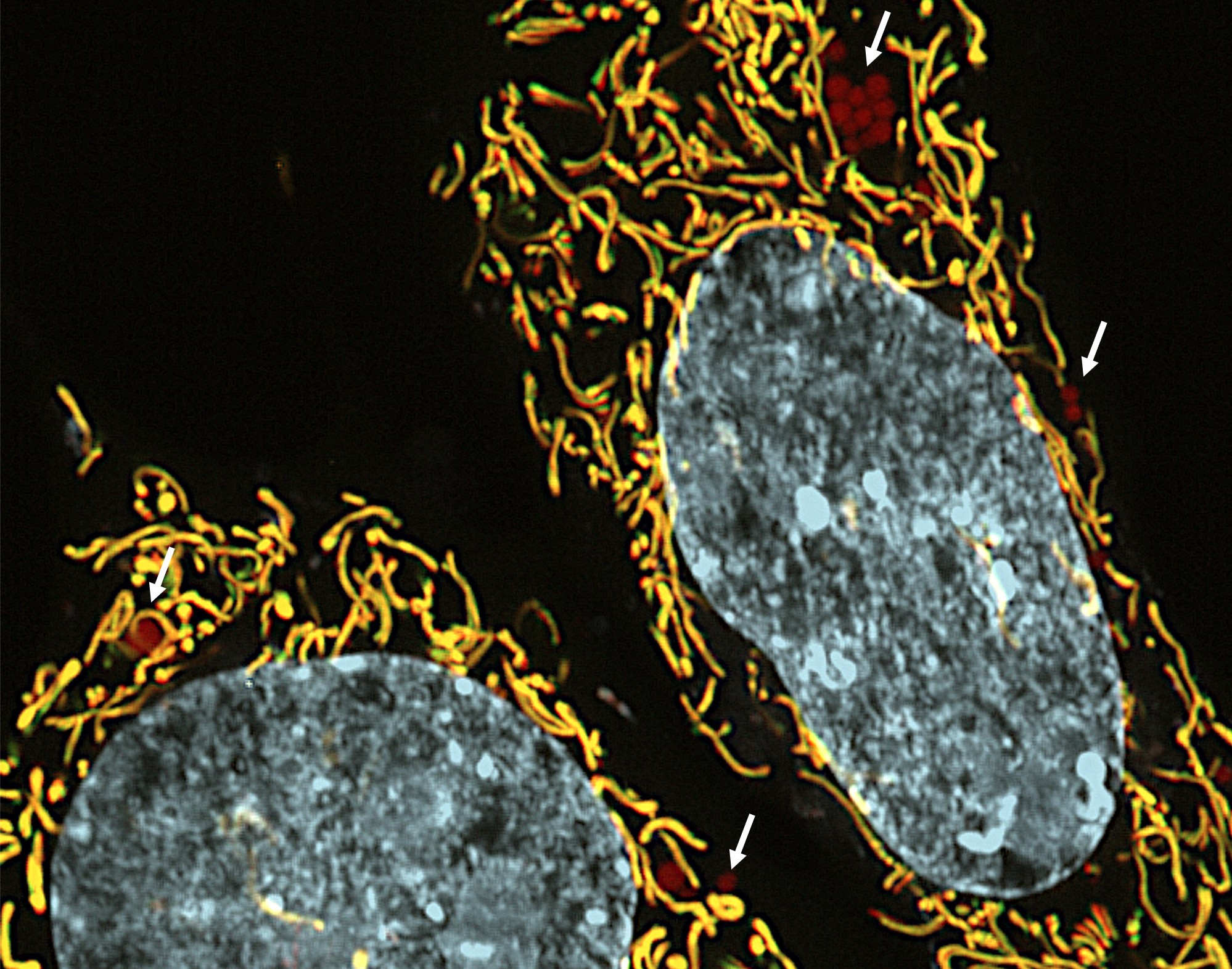 Research reveals possibility of new drug therapy for hereditary diseases