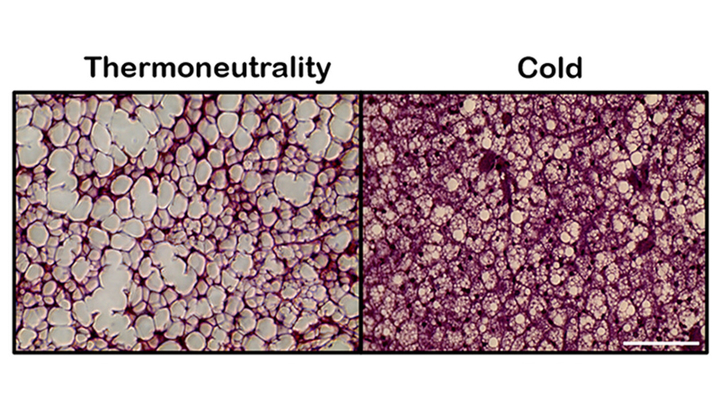 Study paves the way for new therapeutic strategies against obesity