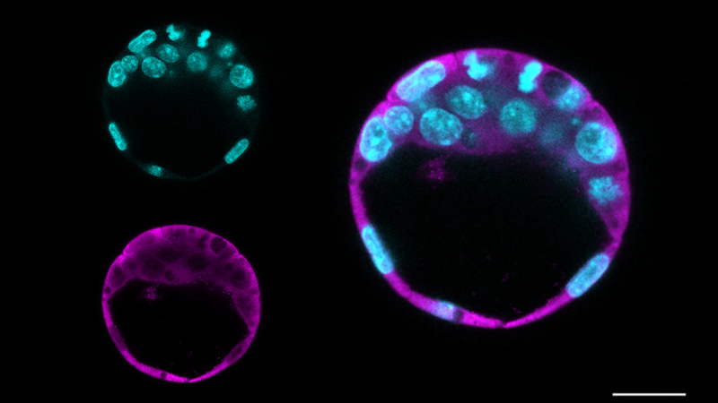 Pesquisas desvendam novas funções de duas proteínas para a renovação de células