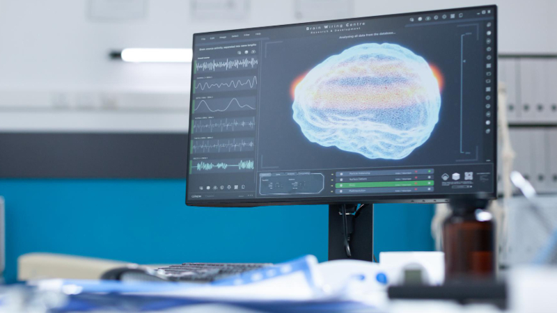 Estudo combina neuromodulação e fisioterapia para reabilitar pacientes após AVC