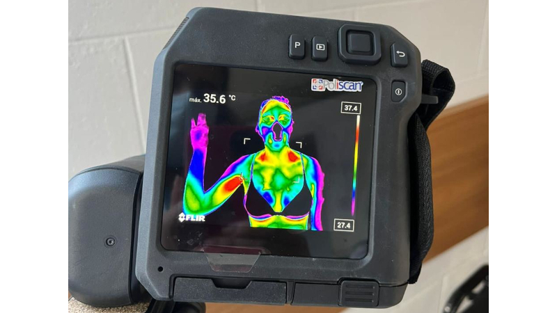 ‘Efeito sanfona’ prejudica o metabolismo e reduz a atividade da gordura marrom em mulheres