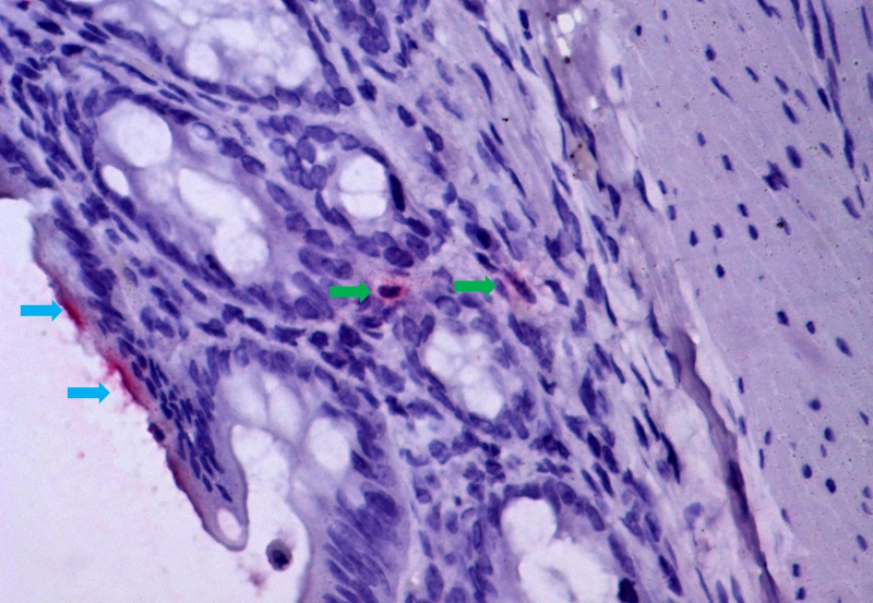 Daño gastrointestinal agrava la fiebre amarilla