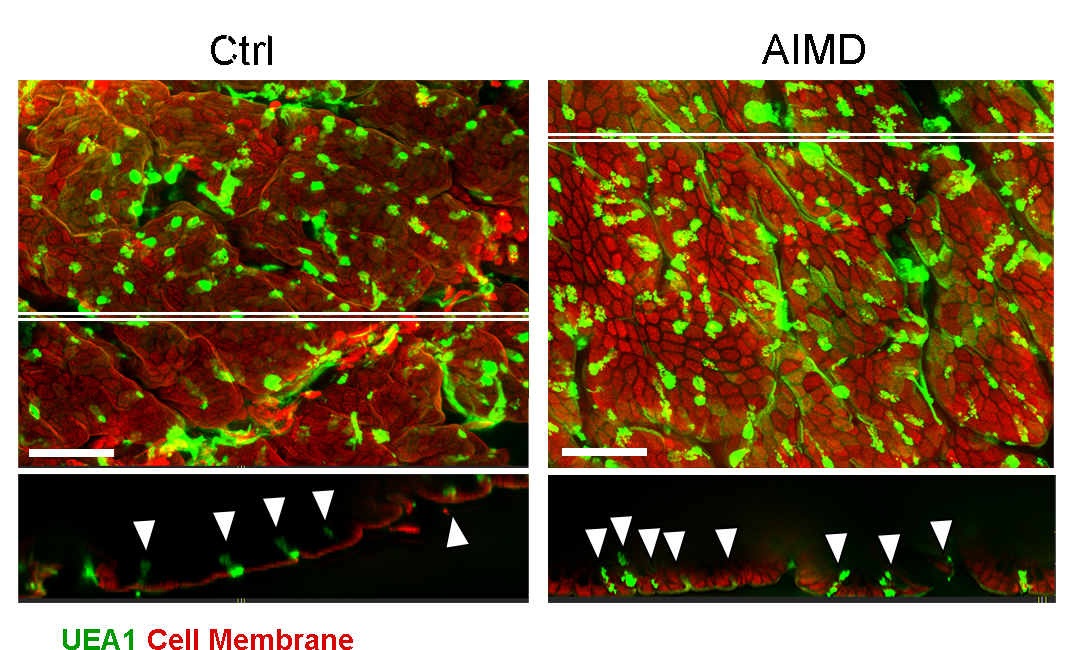 Loss of microbiota alters the profile of cells that protect the intestinal wall