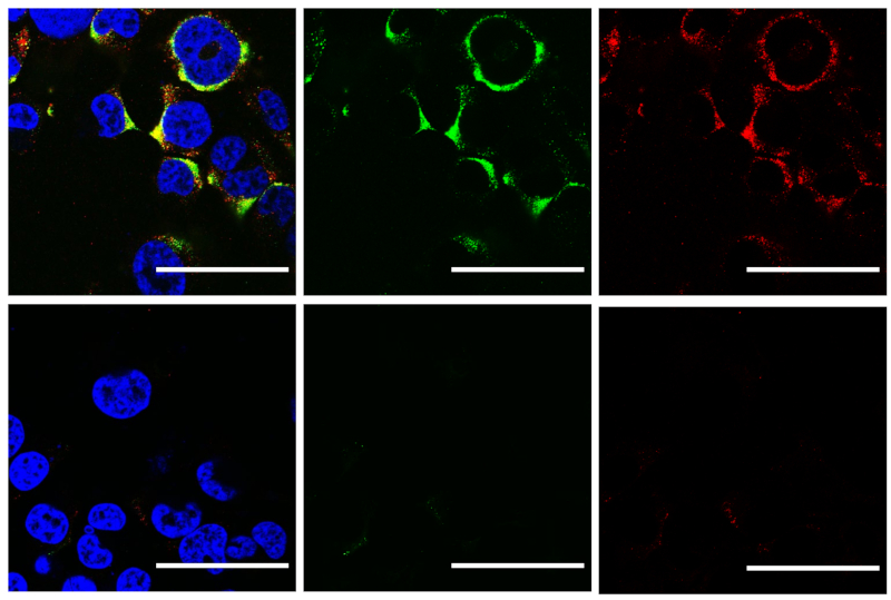 Scientists use ultrasound to destroy influenza A and COVID-19 viruses without damaging human cells