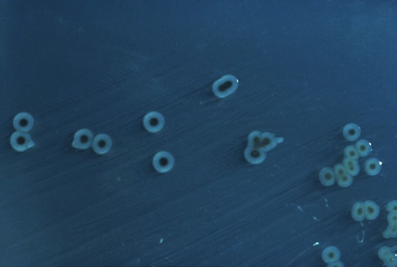 Estudio revela 45 nuevas toxinas producidas por bacterias asociadas a infecciones alimentarias