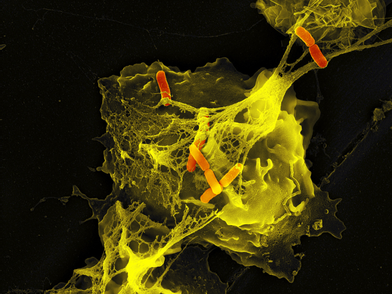 Neutrophils adopt different defense strategies depending on the stimulus