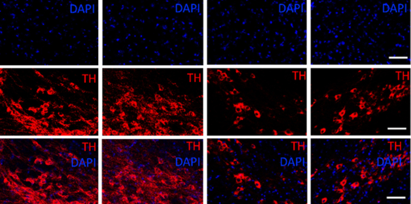 Anti-inflammatory molecule shows potential against Parkinson’s in study with mice