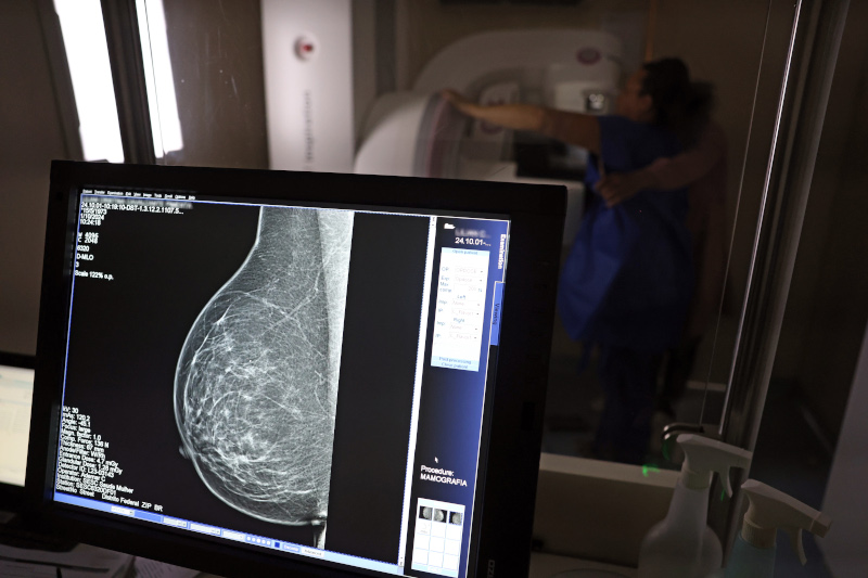 Fear, pain, shame, and inequality prevent women from getting screened for cervical and breast cancer