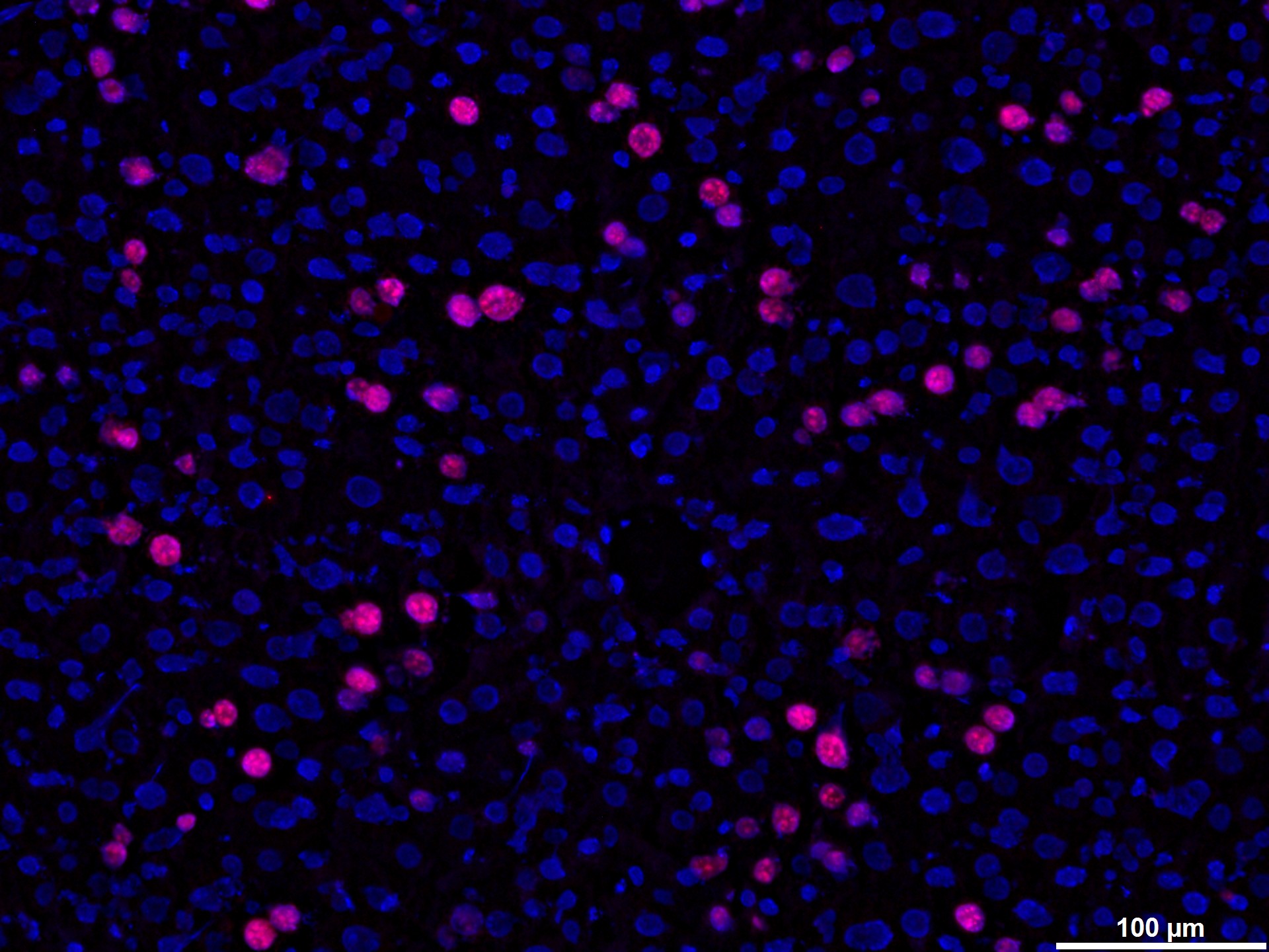 Use of supplement before surgery improves liver regeneration