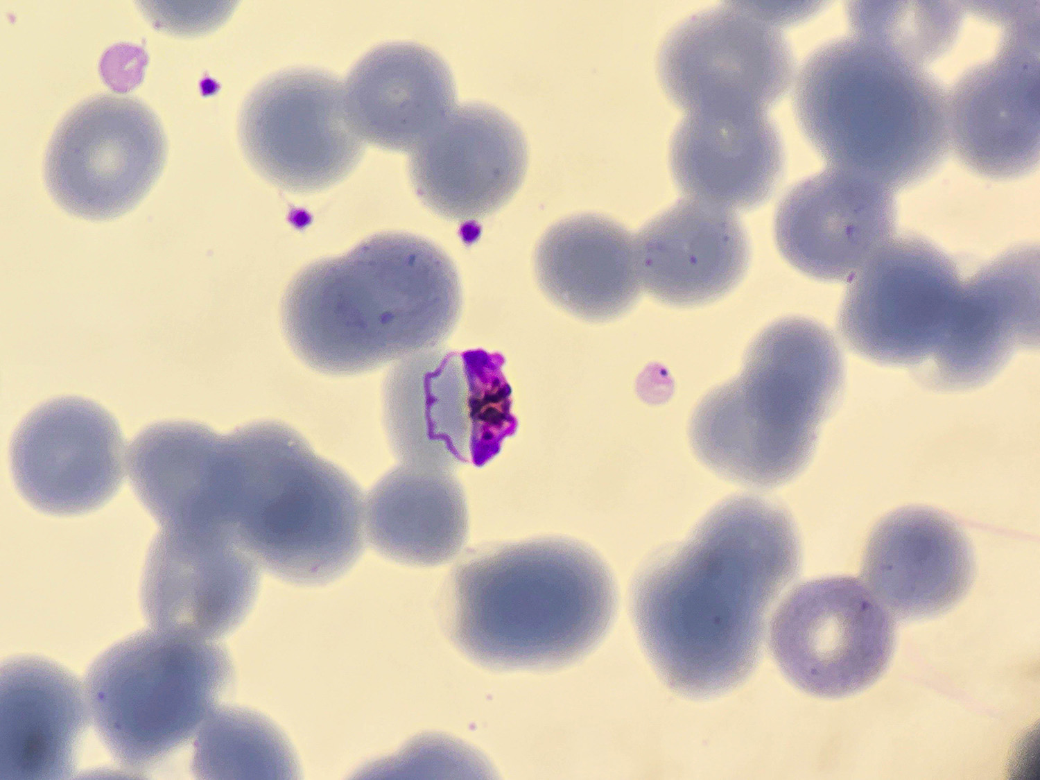 Anti-cancer molecules show promise in the fight against malaria
