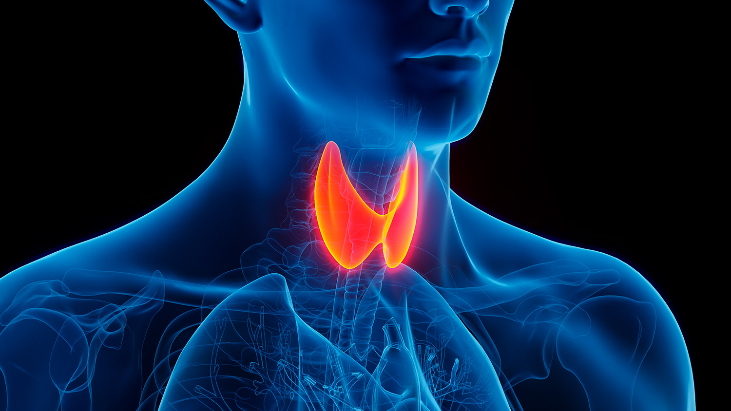 Inteligência artificial prevê risco de complicação após cirurgia de tireoide