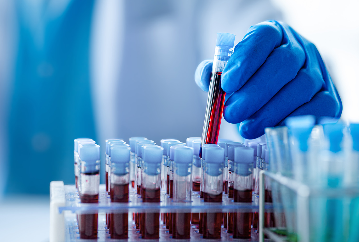 Biorrepositório brasileiro pode ajudar a personalizar a prevenção do câncer no SUS